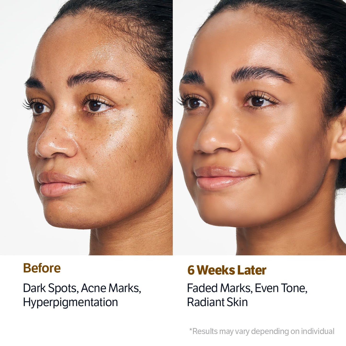 Last 3 Hours 50% OFF  ✨ BUY 2 GET 2 🔥Editor Glass Skin Collagen Volufiline Cream-in-Serum | Gentle, Nourishing &Comfort Korean Skincare Moisturizer for Firming & Hydrating