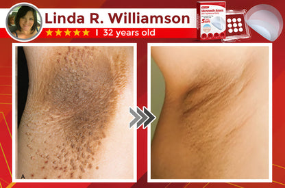 ✅Negusy™ MicroNeedle Botanic Skin Tag Removal Patches – 🇺🇸 Made in the USA | Fast, Painless, Plant-Powered