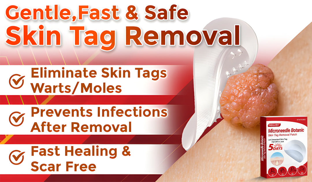 ✅Negusy™ MicroNeedle Botanic Skin Tag Removal Patches – 🇺🇸 Made in the USA | Fast, Painless, Plant-Powered