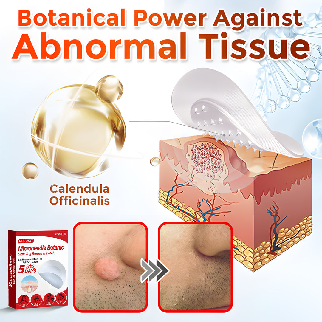 ✅Negusy™ MicroNeedle Botanic Skin Tag Removal Patches – 🇺🇸 Made in the USA | Fast, Painless, Plant-Powered