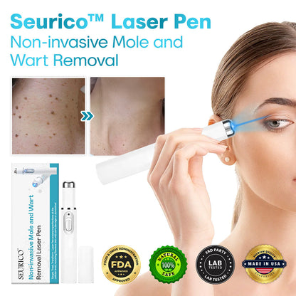 Seurico™ Laser Pen – Non-Invasive Mole and Wart Removal 1–3 days